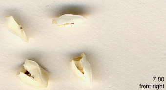 teeth